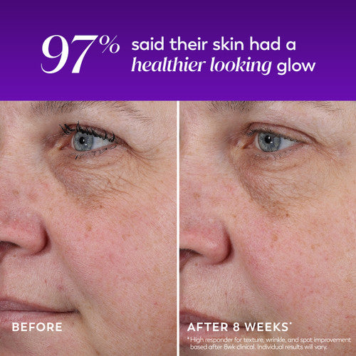 Regenerist Resurfacing Peel Night Treatment