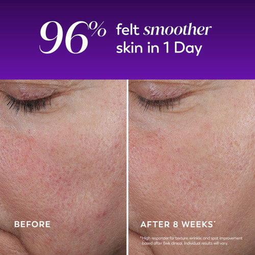 Regenerist Wrinkle Correcting Night Treatment