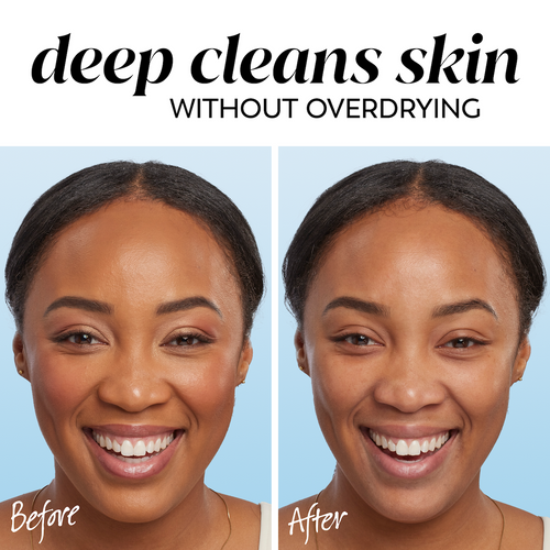 Olay Gentle Cleansing Melts